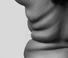 Conceptos generales sobre la obesidad