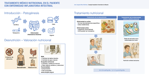 Infografía